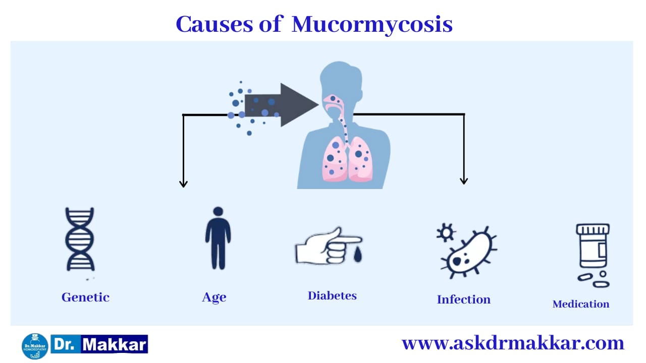 Cause of Mucormycosis || Black Fungus || Zygomycosis || ब्लैक फंगस के कारण
