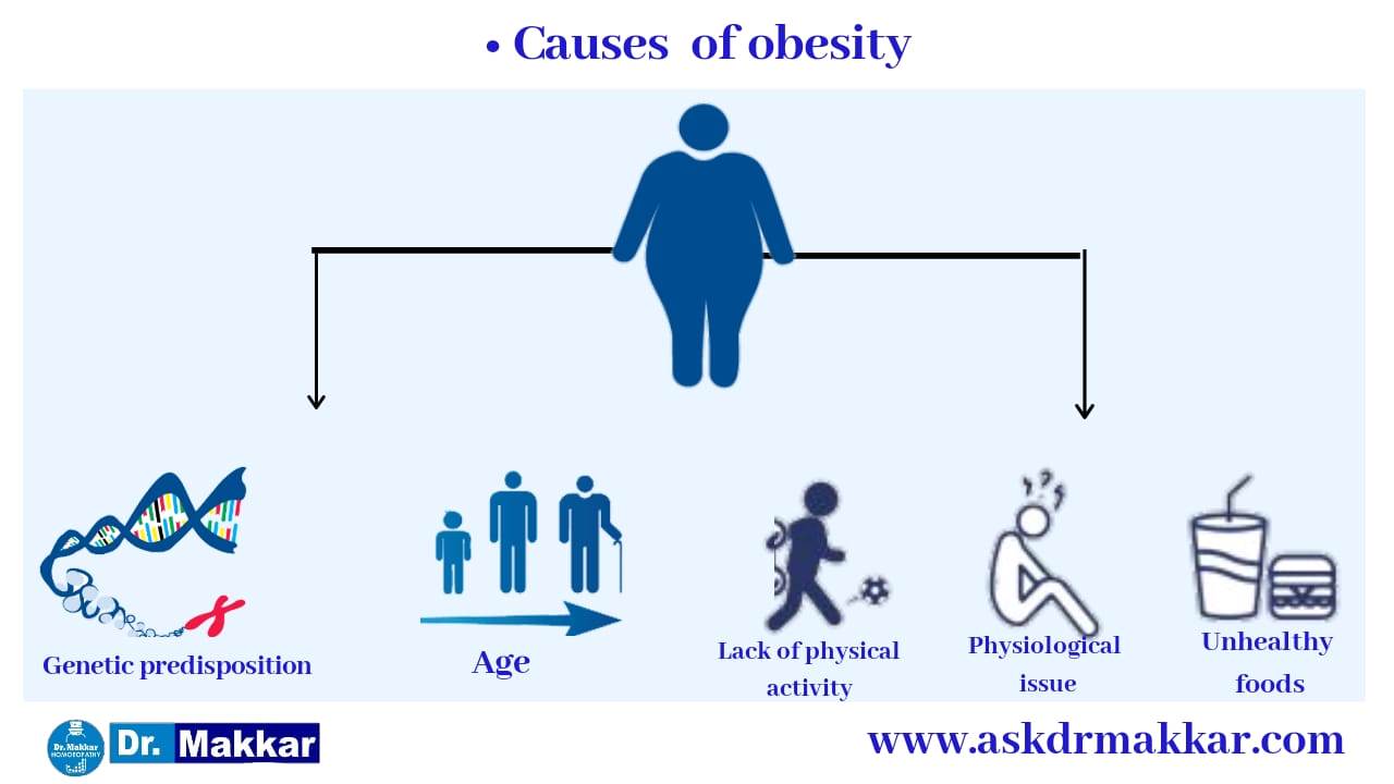 Causes of Obesity Weight Loss of overweight issue