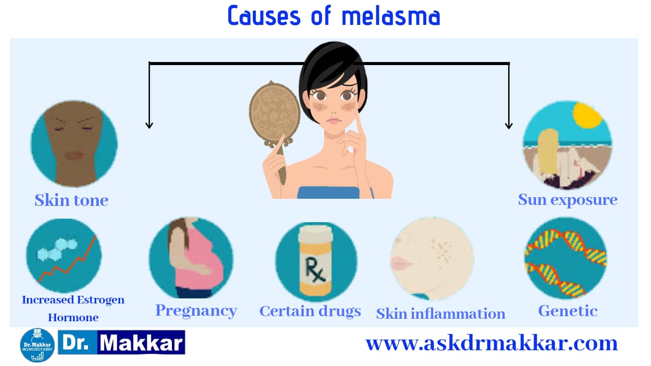 Causes of malesma cholasma