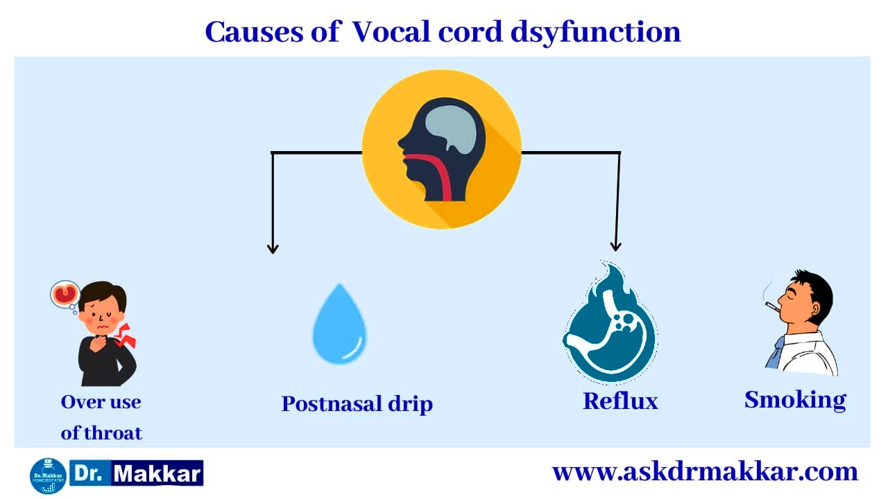 Causes for Vocal cord polyp commonly occur in public speaker like politician teacher singers || वोकल कॉर्ड पॉलिप स्वर ग्रंथि  आमतौर पर राजनीतिज्ञ शिक्षक गायकों की तरह सार्वजनिक स्पीकर मुखर कॉर्ड पोलिप रीज़न के कारण 