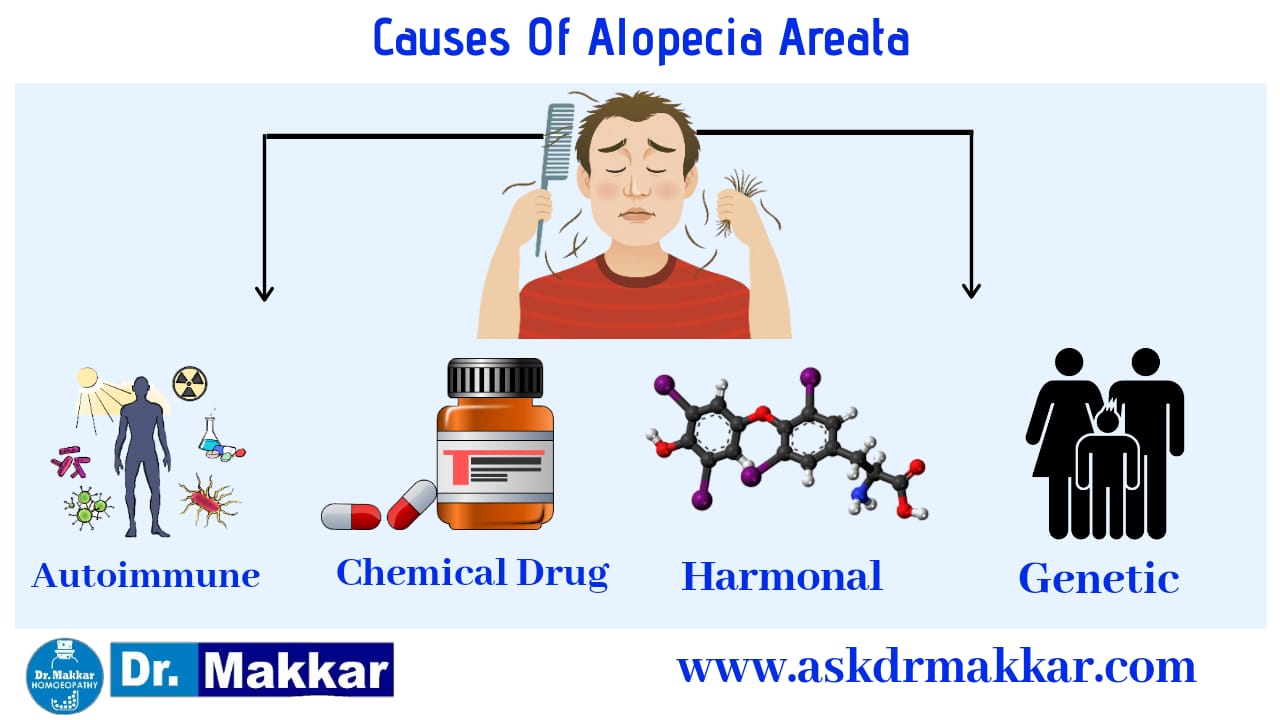 Causes of Alopecia aerata hair loss
