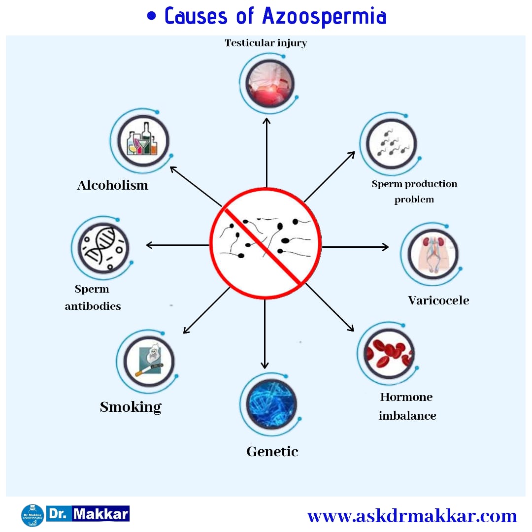 Causes of Azospermia nil sperm || निल स्पर्म  शुक्राणुहीनता ट्रीटमेंट एज़ोस्पर्मिया के कारण