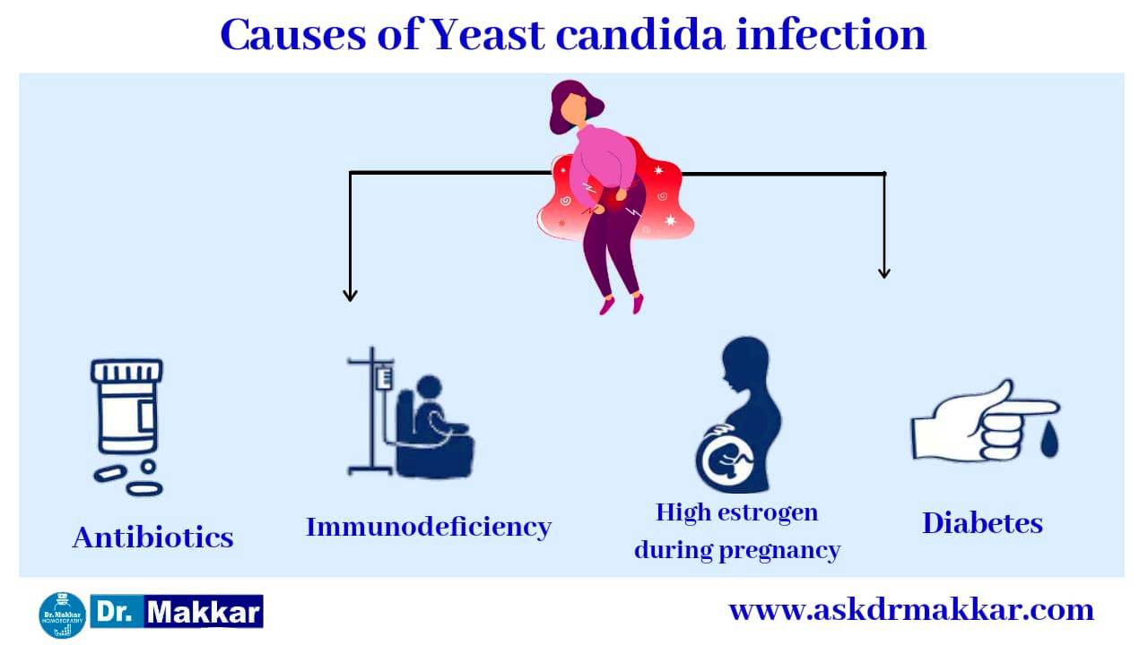 Causes of Candidiasis yeast infection  || यीस्ट इन्फेक्शन इन वेजिना में जलन के कारण