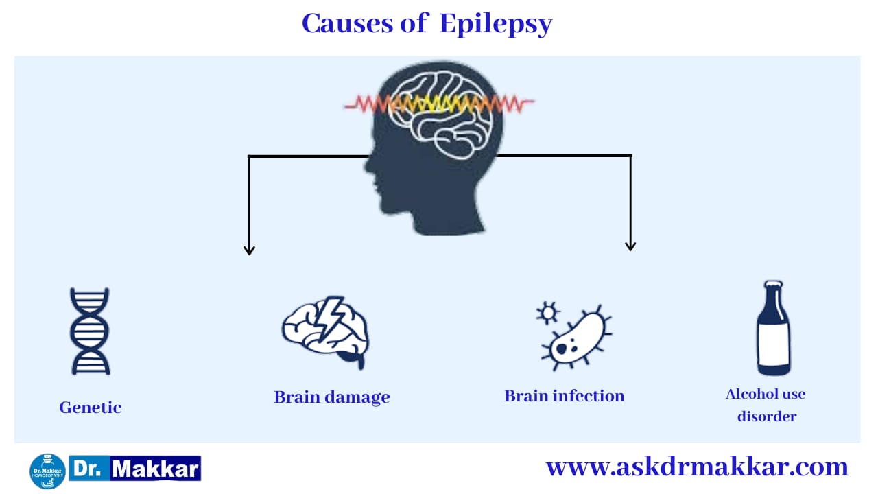 Causes of Epilepsy seizure  मिर्गी का दौरा के कारण