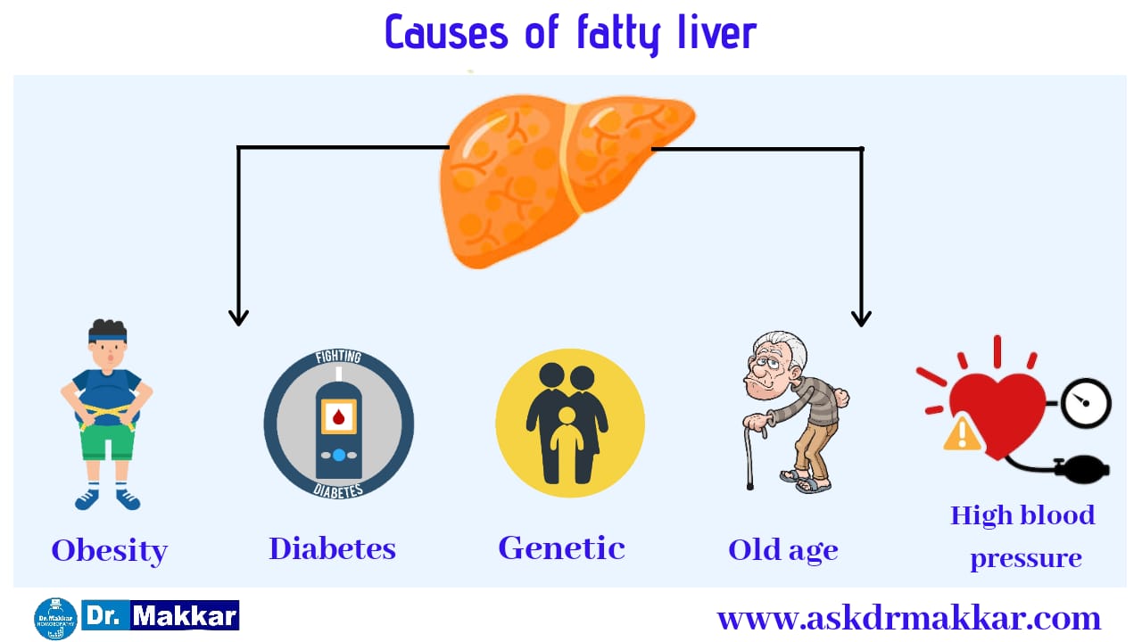 Causes of Fatty liver 