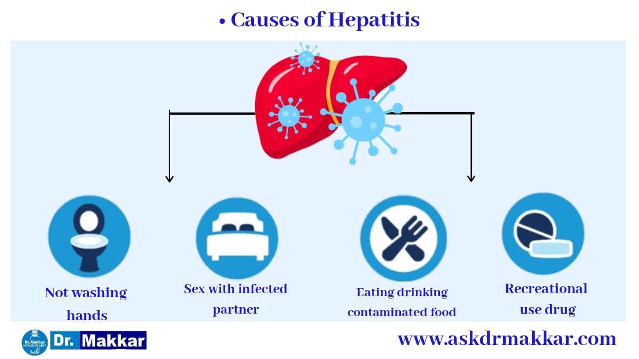 Causes of Hepatitis B HBV  यकृतशोथ ख (हेपाटाइटिस बी) हेपाटाइटिस बी वायरस (HBV) रोग के कारण