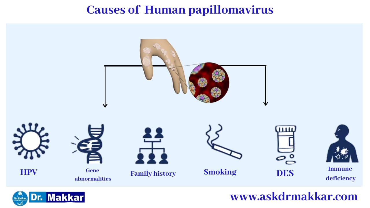 Causes of Human Pappiloma Virus HPV ||  ह्यूमन पेपिलोमा वायरस एचपीवी के कारण