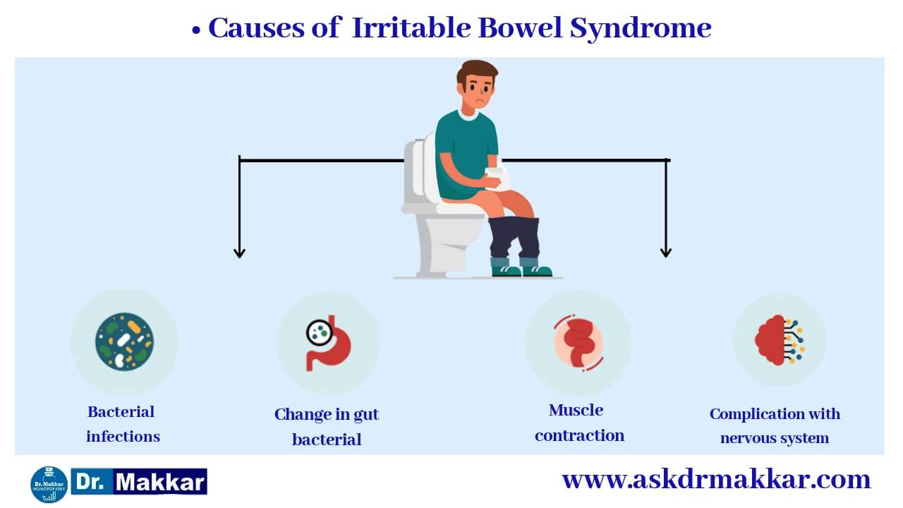 Causes of Inflammatory bowel disease IBD   संवेदनशील आंत्र संलक्षण आईबीएस इरिटेबल बॉवेल सिंड्रोम स्पॉन्डिलाइटिस के कारण