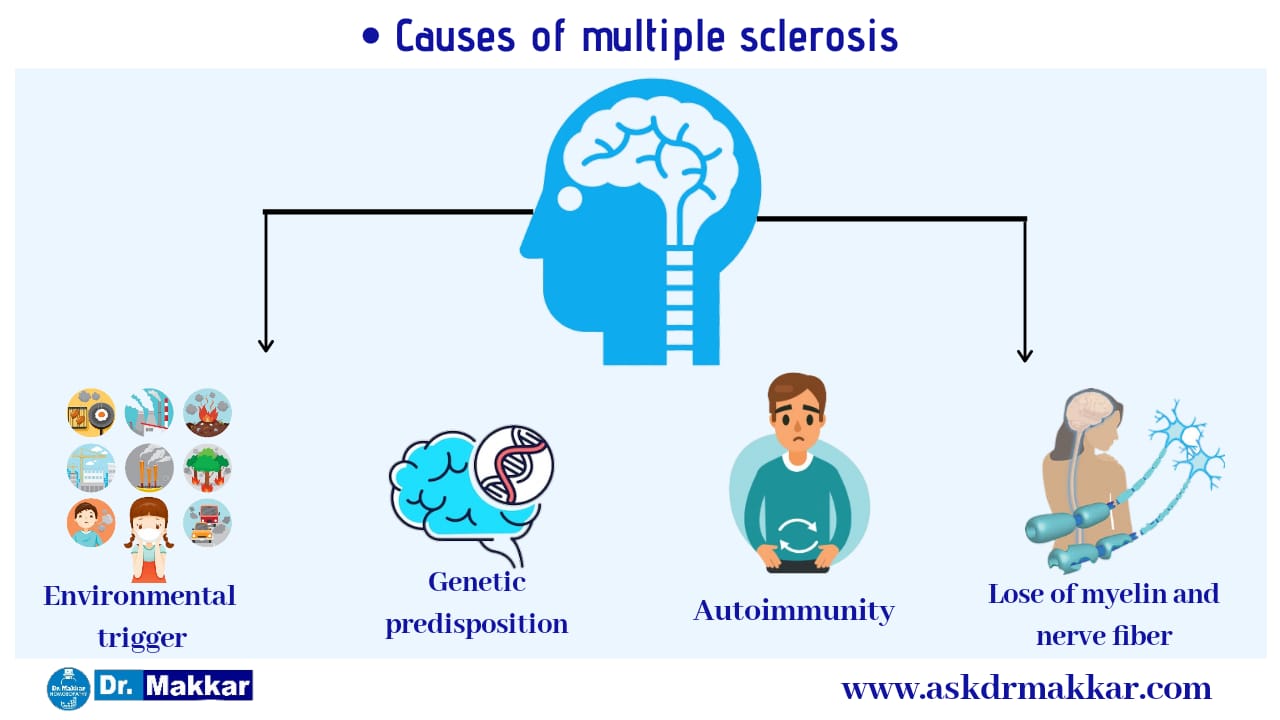 Causes of Multiple Sclorosis MS