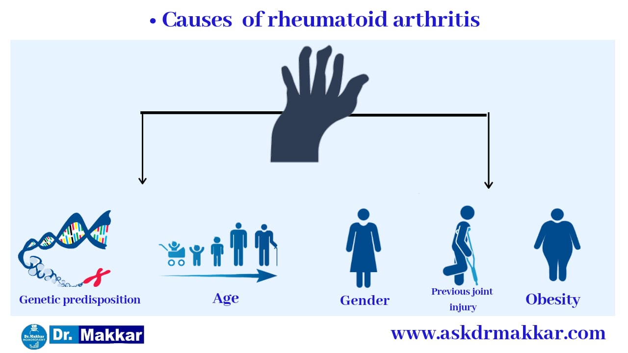 Causes of Rheumatoid arthritis 