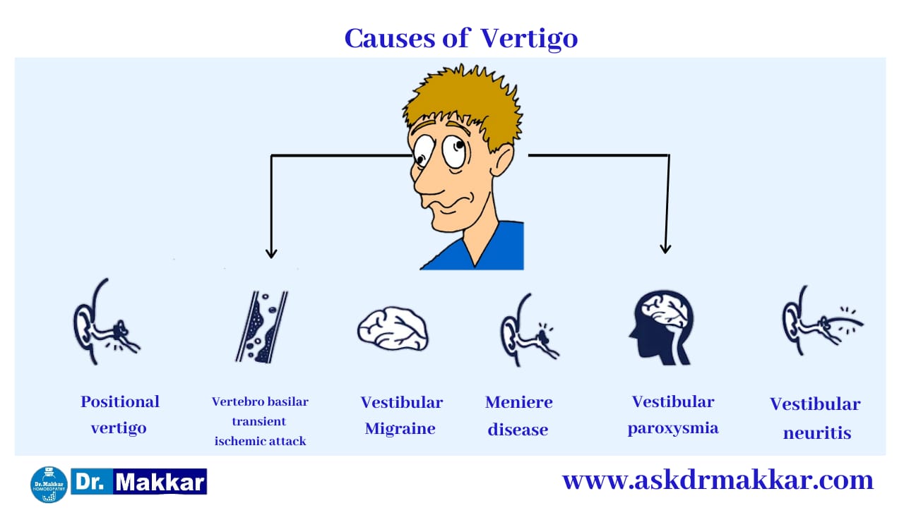 Causes of Vertigo || सिर का चक्कर के कारण