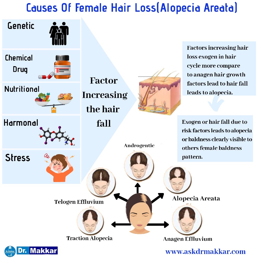 Causes of hair loss in female & pattern