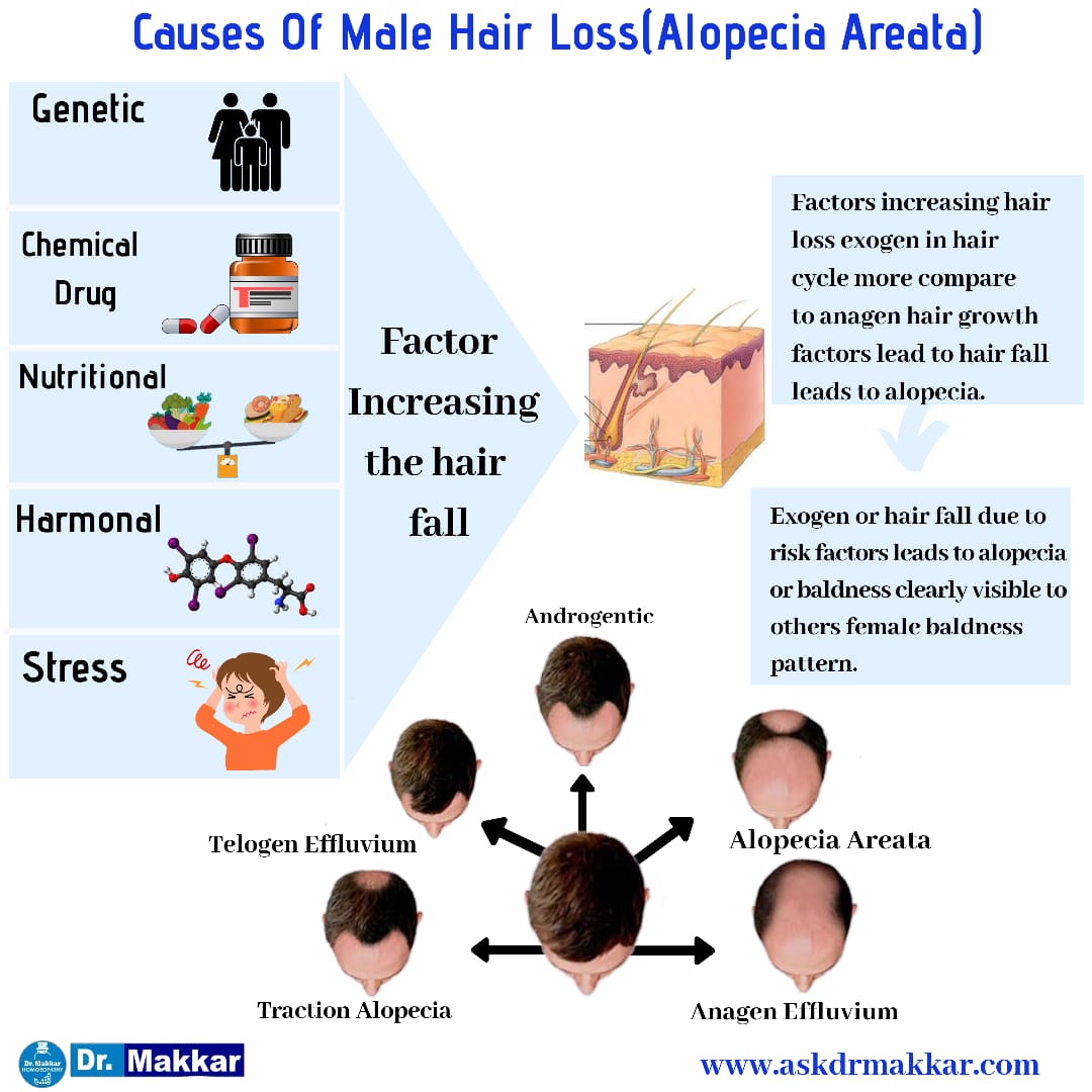 Causes of hair loss in male