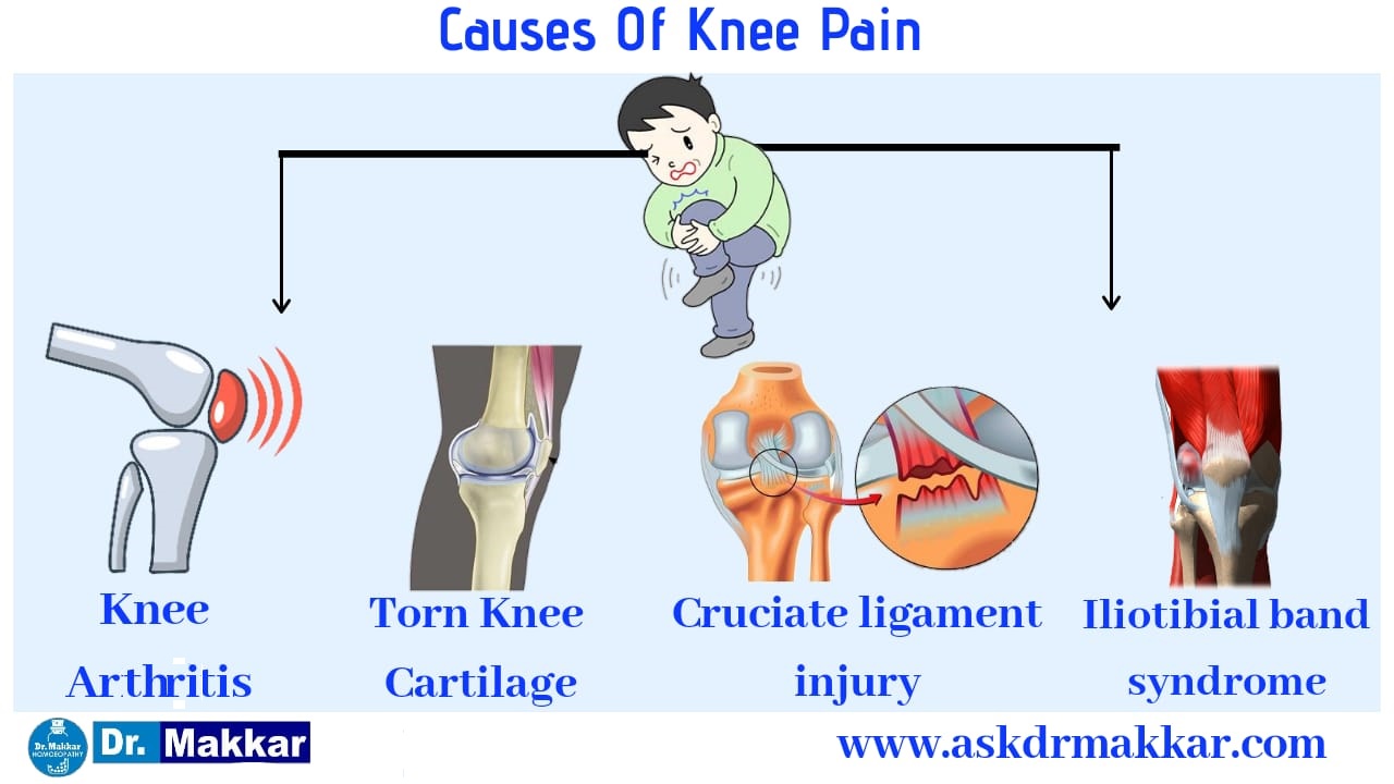 Causes of knee pain homeopathic approach like arthritis,cruciiate ligament injury,iliotibial band injury