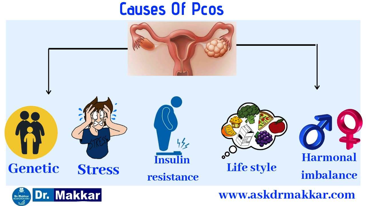Causes of pcos polycystovarian syndrome