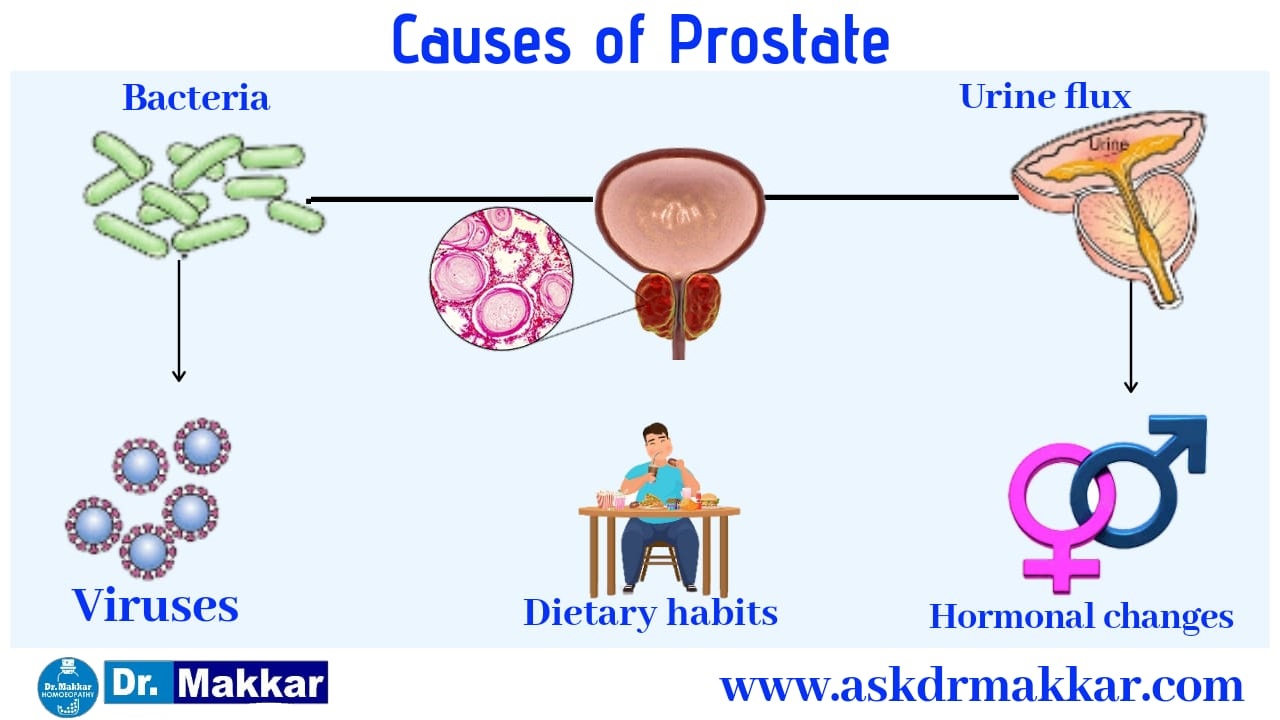 Causes of prostrate in detail india
