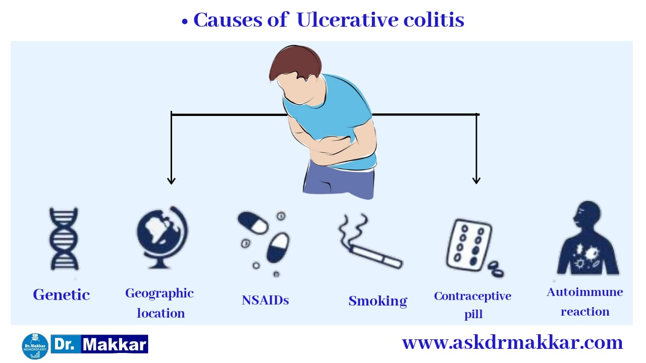 Causes of ulcerative colitis || आंतों में सूजन अल्सरेटिव कोलाइटिस के कारण