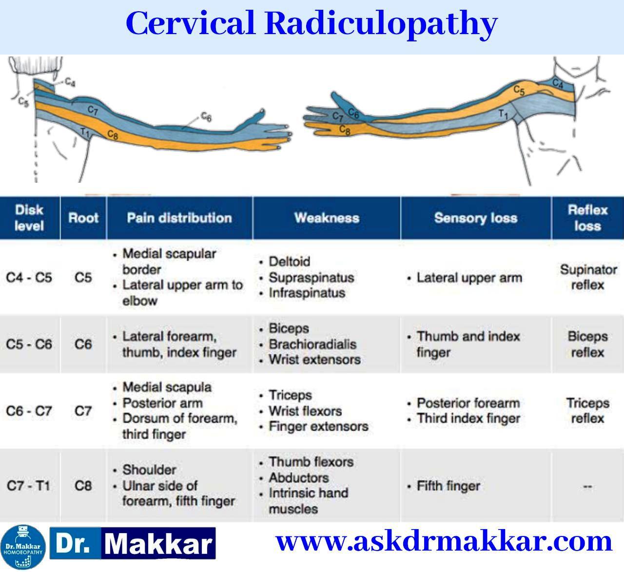 Shoulder Pain Actually neck pain sometimes in spondylosis part of Cervical Rediculopathy || कंधे का दर्द वास्तव में गर्दन का दर्द कभी-कभी सर्वाइकल रेडिकुलोपैथी के स्पोंडिलोसिस में होता है