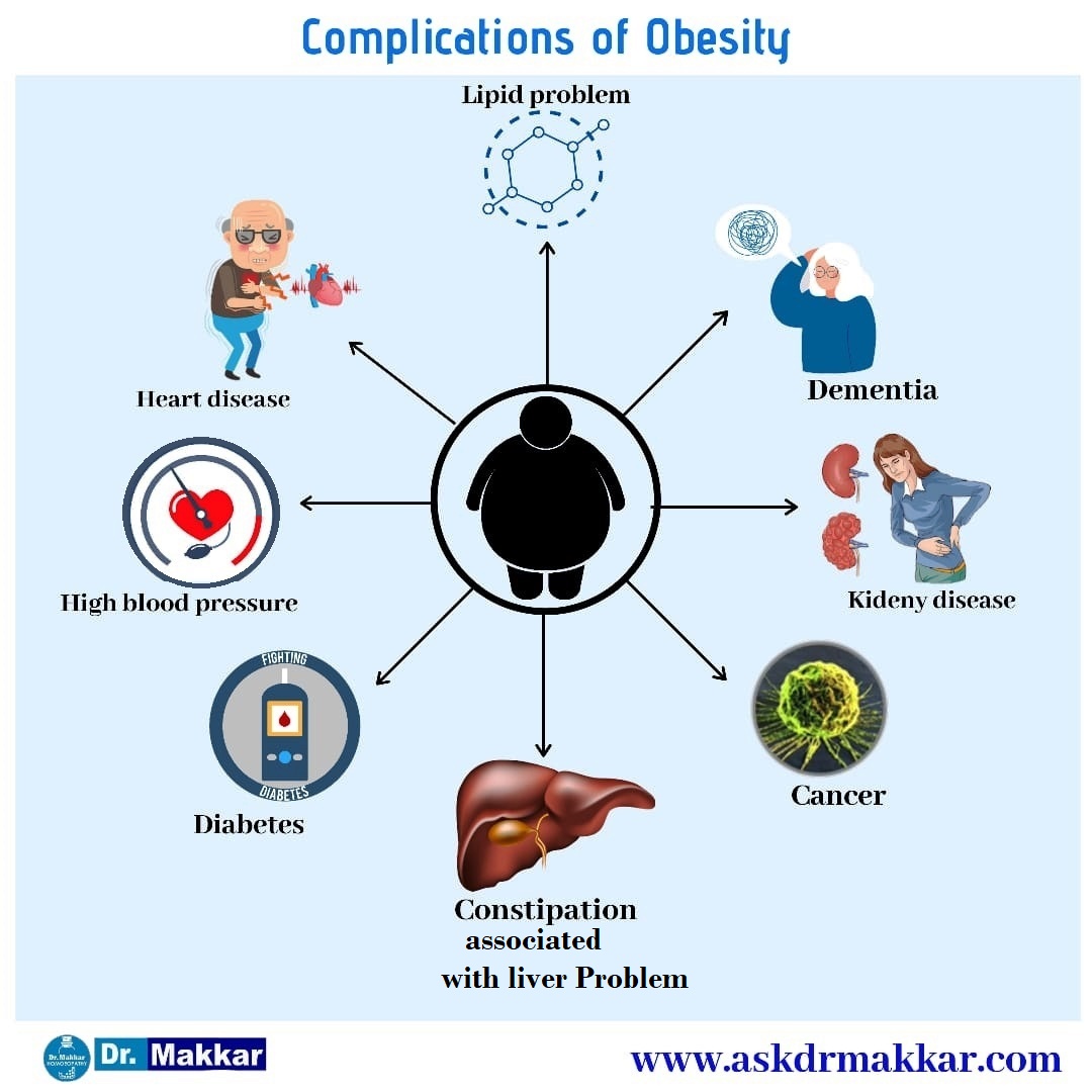 Complication in association with Obesity weight gain,diabeties,heart disease,lipid,dementia,constipation,