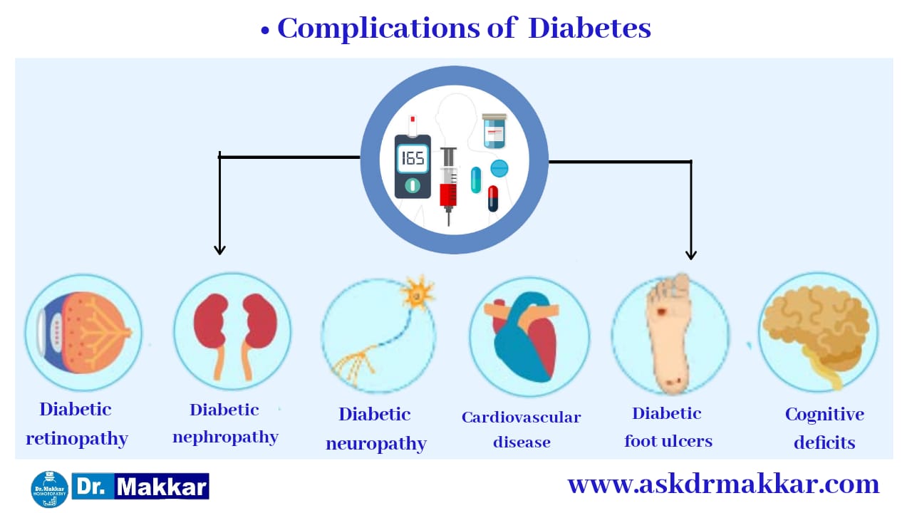 Complication of Diabetes