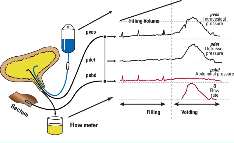 Urine flow metery  Pressure test (Cystometry)