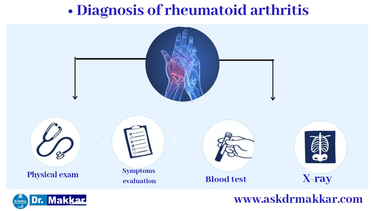 Diagnosis Of Rheumatoid Arthritis