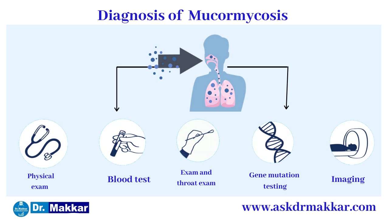 Diagnosis and investigations for  Mucormycosis || Black Fungus || Zygomycosis || ब्लैक फंगस की मूल्यांकन  जाँच पड़ताल