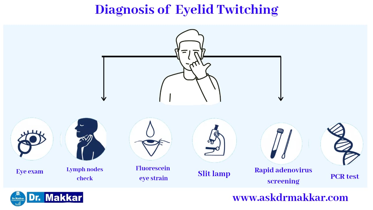 Diagnosis and investigations for Blepharospasm Twitching eyelid || ब्लेफरोस्पाज्म आंख फड़कने झपकना की मूल्यांकन  जाँच पड़ताल