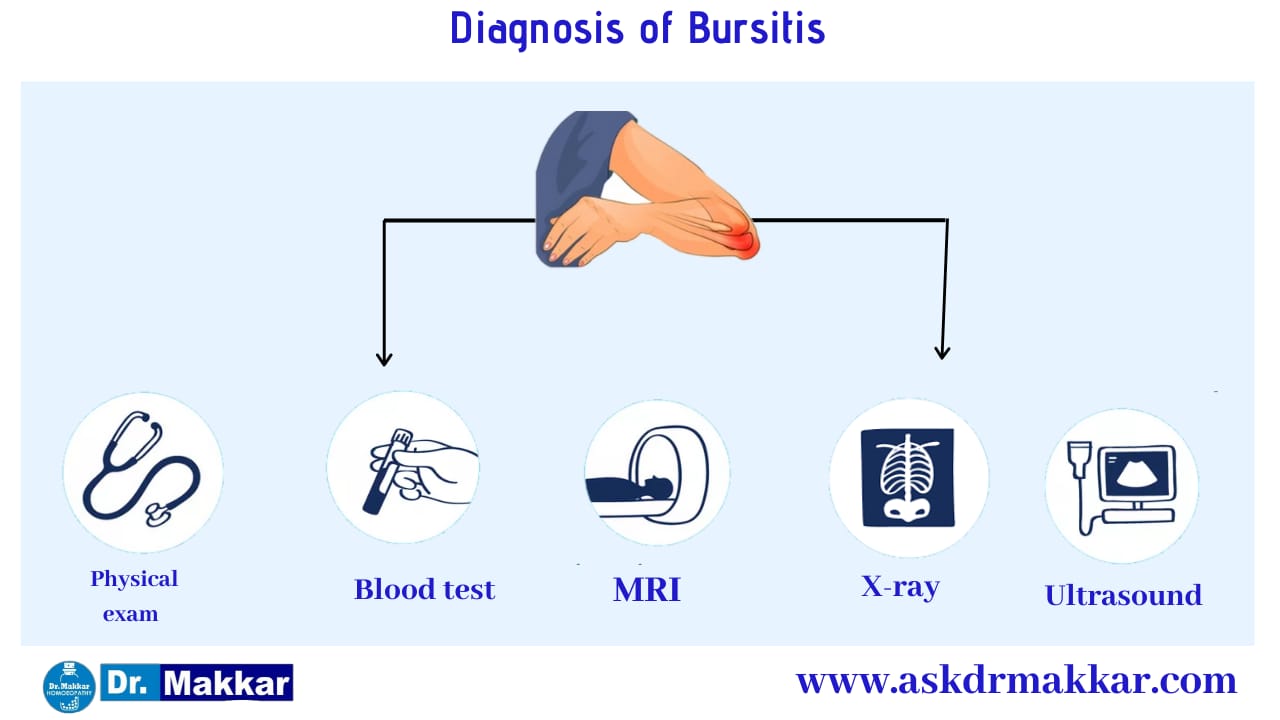Diagnosis and investigations for Bursitis || बर्साइटिस की मूल्यांकन  जाँच पड़ताल