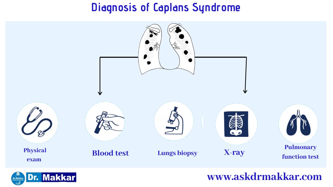 Diagnosis and investigations for Caplan’s Syndrome || कैपलन सिंड्रोम की मूल्यांकन जाँच पड़ताल