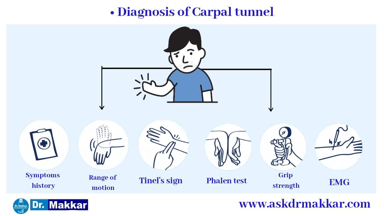 Diagnosis and investigations for Carpal tunnel syndrome || कार्पल टनल सिंड्रोम की मूल्यांकन  जाँच पड़ताल
