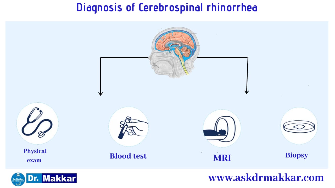 Diagnosis and investigations for Cerebrospinal Fluid (CSF) Leak Rhinorrhea || सेरिब्रल स्पाइनल फ्लूइड लीक रिसाव राइनोरिया जाँच पड़ताल