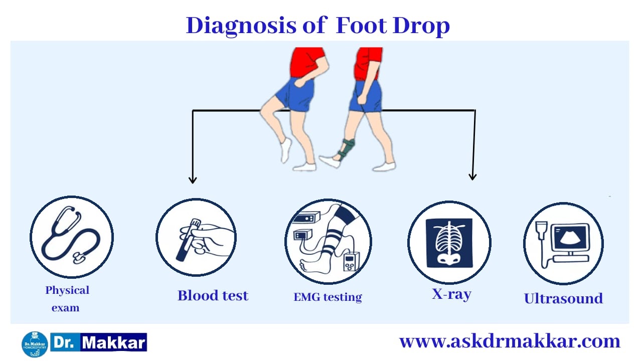 Diagnosis and investigations for Foot Drop Peroneal Nerve || फुट ड्राँप अनुजंघास्थिक तंत्रिका की मूल्यांकन  जाँच पड़ताल