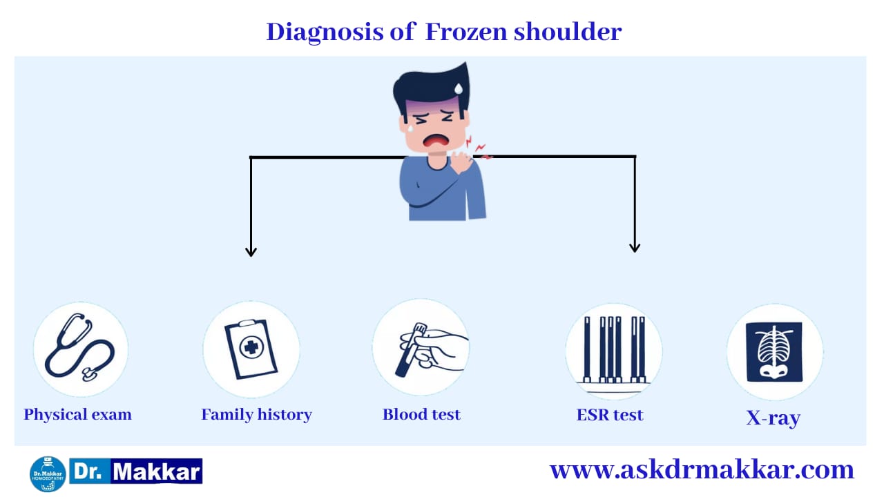 Diagnosis and investigations for Frozen Shoulder stiffness of shoulder || कंधे की अकड़न फ्रोज़न शोल्डर की मूल्यांकन  जाँच पड़ताल