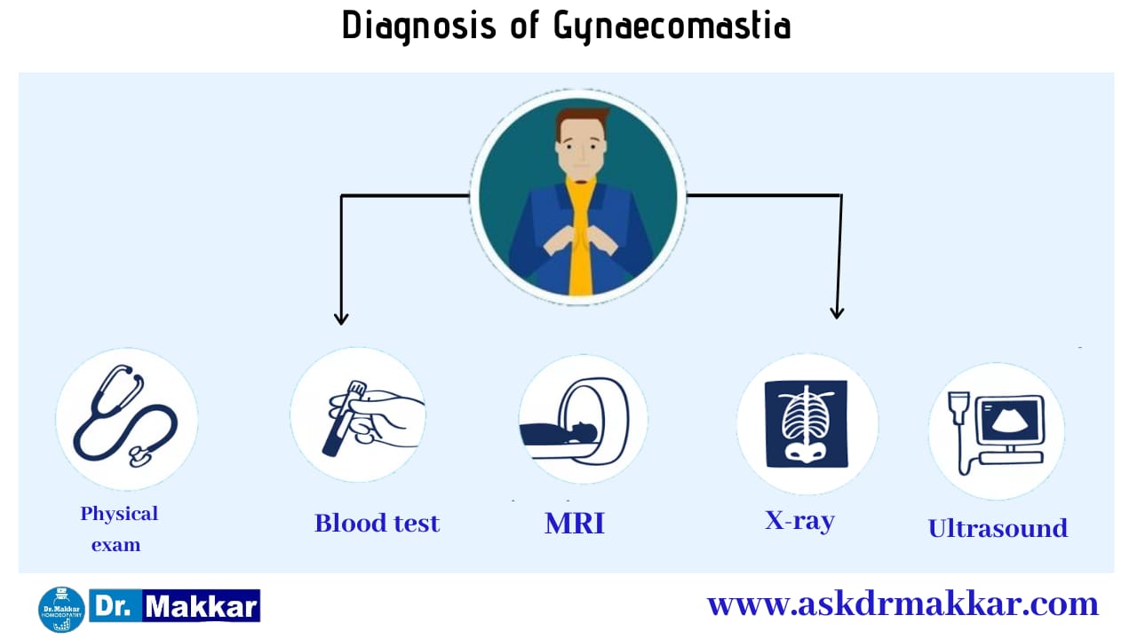 Diagnosis and investigations for Gynecomastia Enlarged Male Breast Tissue || ज्ञ्नेकोमास्टिया बढ़े हुए पुरुष स्तन ऊतककी मूल्यांकन  जाँच पड़ताल