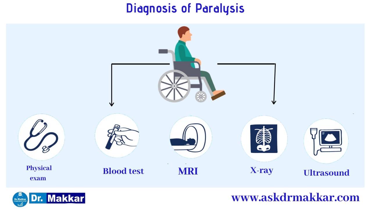 Diagnosis and investigations for Paralysis || लकवा मारना पक्षाघात  की मूल्यांकन  जाँच पड़ताल