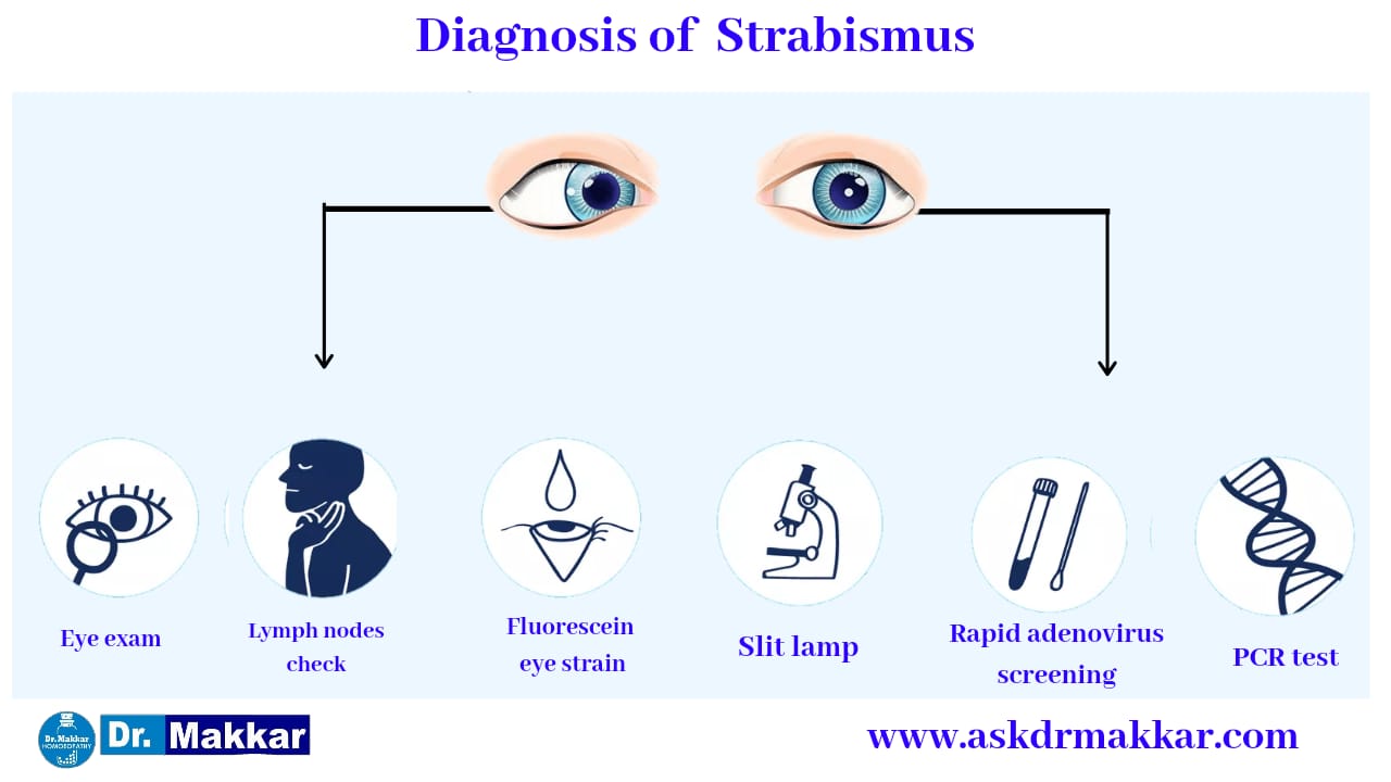 Diagnosis and investigations for Strabismus Crossed Eye || भेंगापन तिर्यकदृष्टि स्ट्राबिस्मस की मूल्यांकन  जाँच पड़ताल