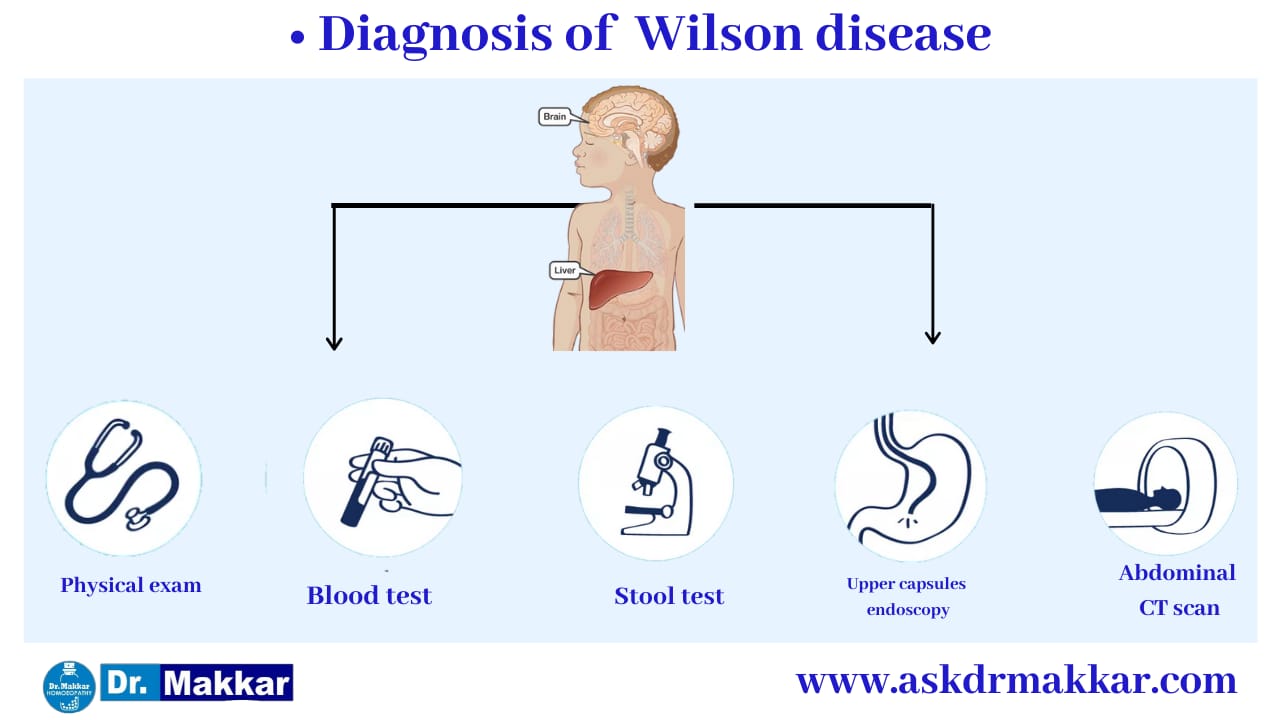 Diagnosis and investigations for Wilson Disease || विल्सन रोग  की मूल्यांकन  जाँच पड़ताल