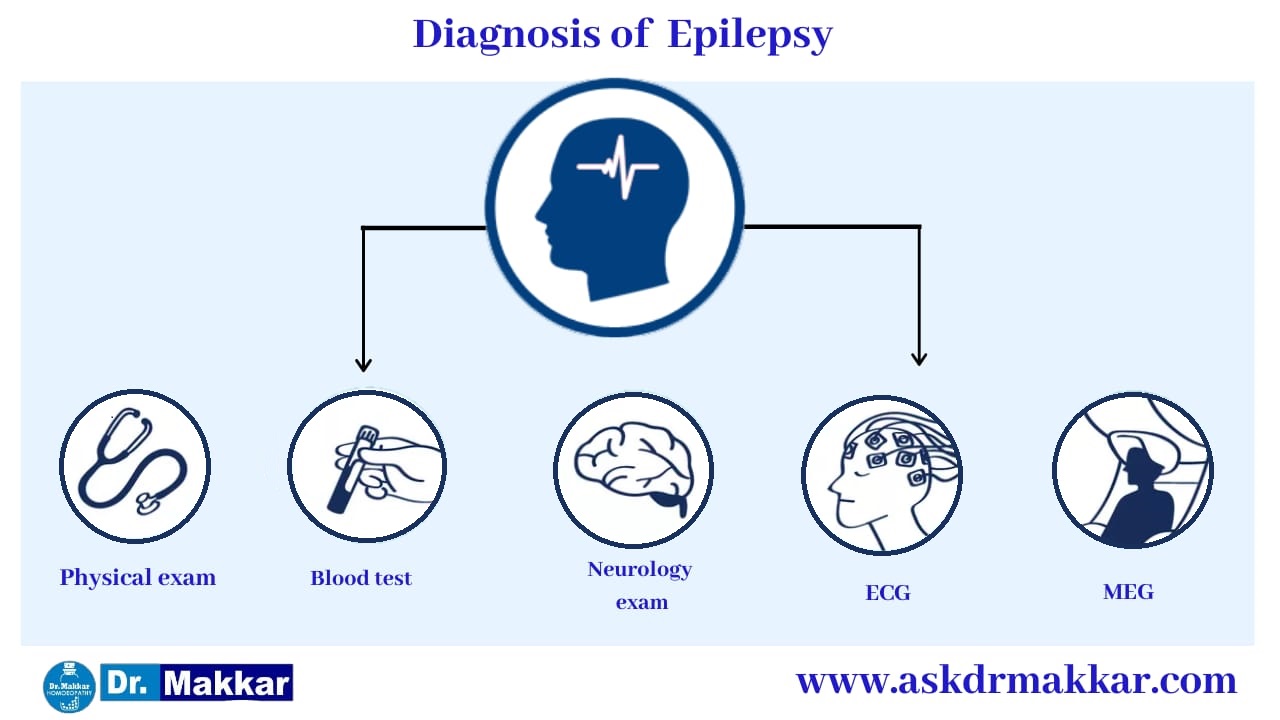 Diagnosis for Epilepsy seizure || मिर्गी का दौरा रोग का निदान