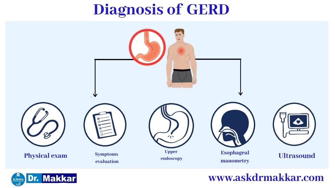 Diagnosis for Gerd Gastrooesophageal Reflux Disease || गर्ड गैस्ट्रोसोफेगल रिफ़्लक्स रोग का निदान