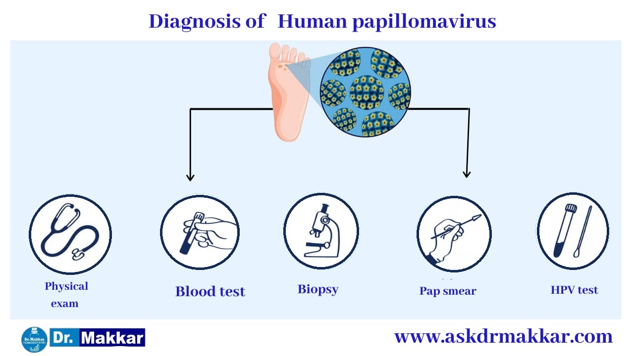 Diagnosis for Human Pappiloma Virus HPV || ह्यूमन पेपिलोमा वायरस एचपीवी  रोग का निदान