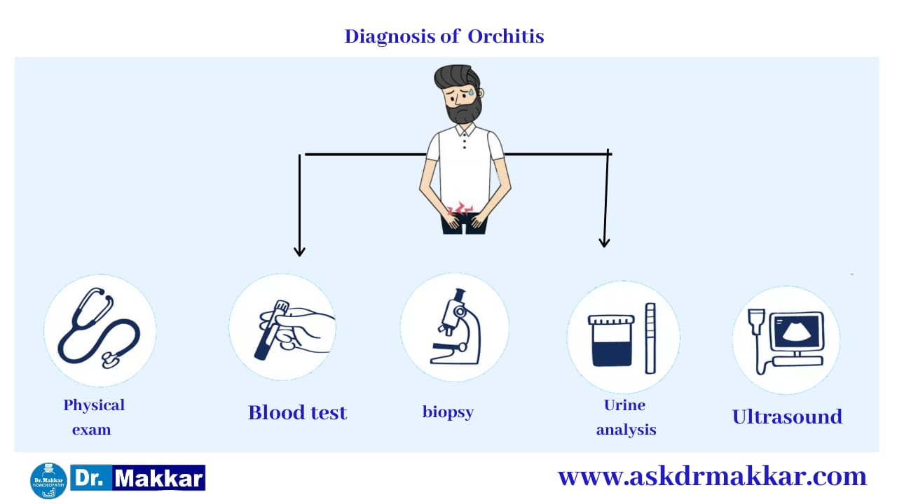 Diagnosis for Orchitis || ऑर्काइटिस का निदान