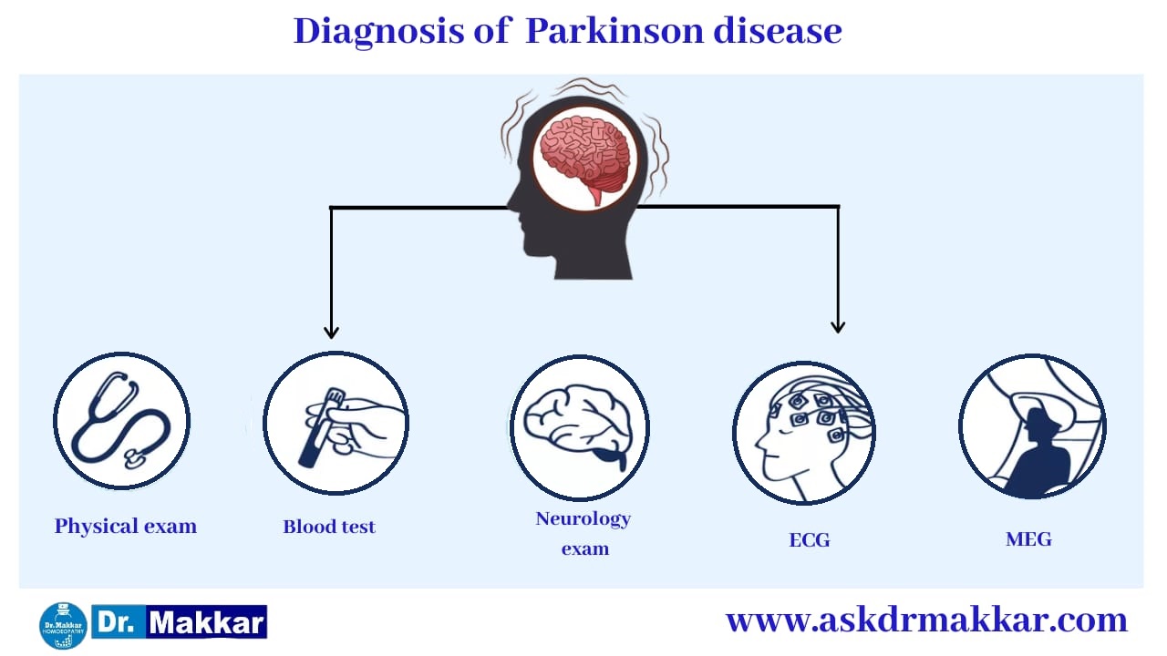 Diagnosis for Parkinson Disease || पार्किंसन डिजीज तंत्रिका तंत्र का निदान