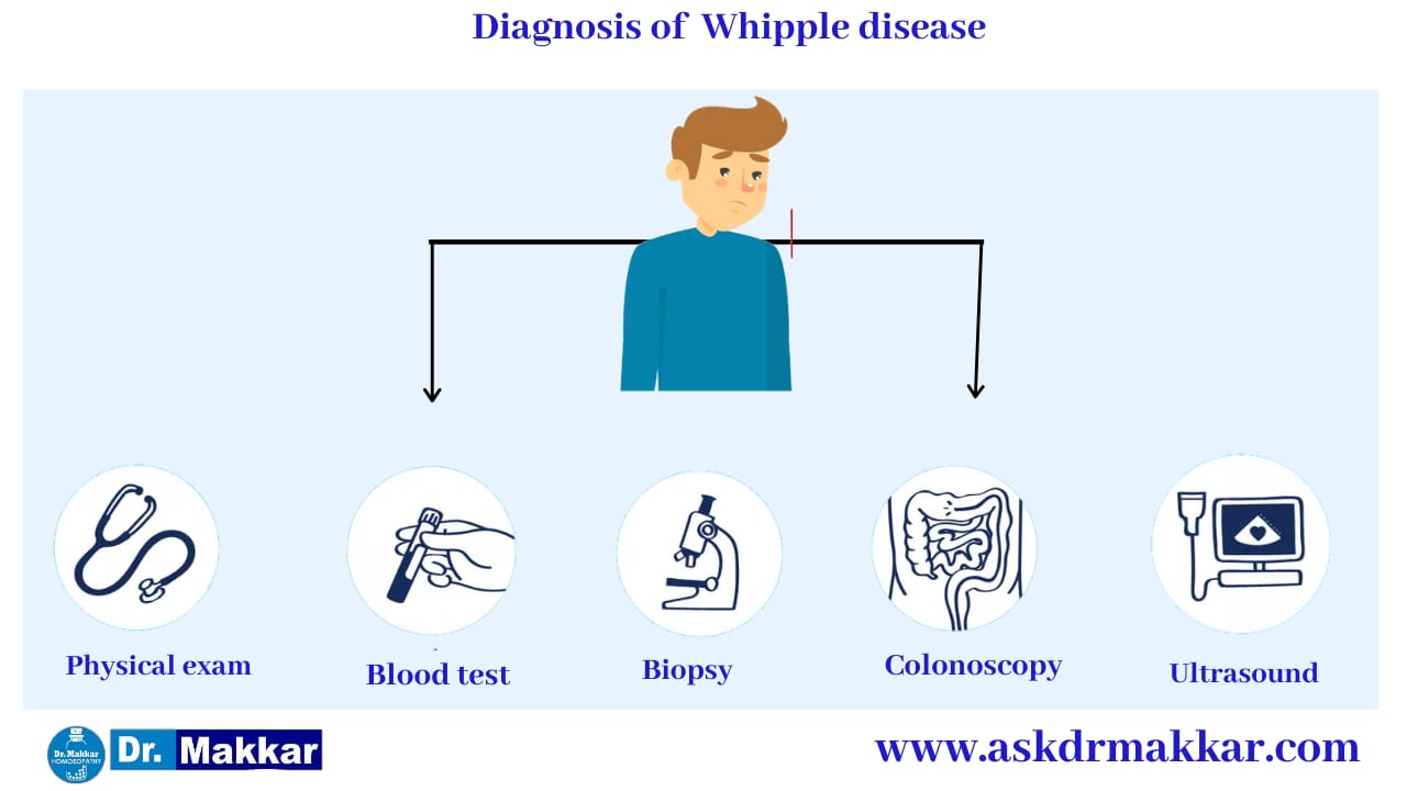 Diagnosis for Whipple’s Disease  व्हिपल रोग का निदान