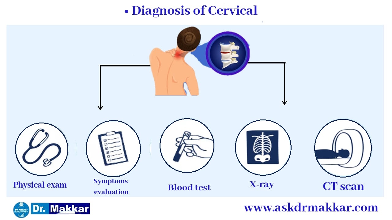 Diagnosis of Cervical Spondylosis || सर्वाइकल स्पोंडिलोसिस का निदान