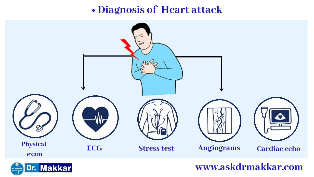 Diagnosis of Heart Attack हार्ट अटैक का निदान 