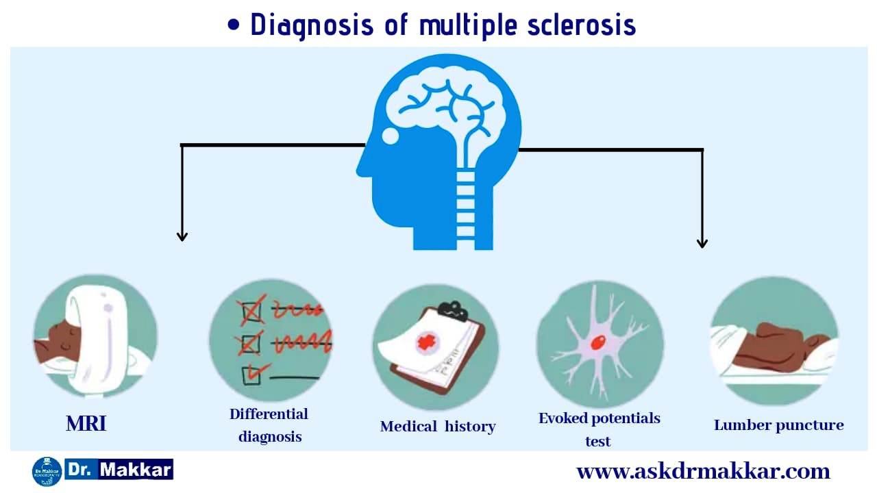 Diagnosis of Multiple Sclorosis