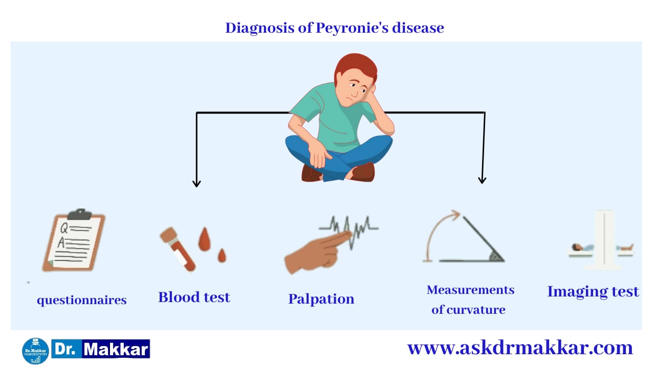 Diagnosis of Peyronies disease curved Penis  पेयरोनी डिजीजलिंग का टेढ़ापन मुंडा लिंग रोग रोग का निर्णय करना