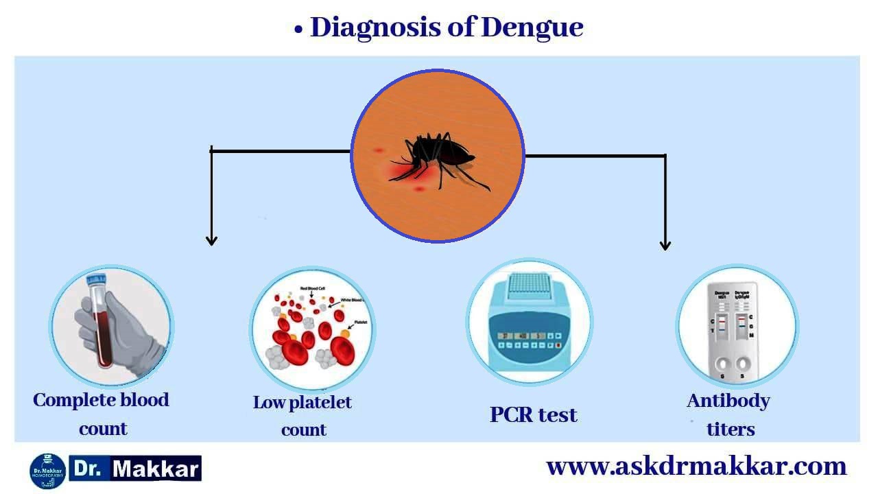 Diagnosis of dengue || डेंगू फीवर और डेंगू टेस्ट्स