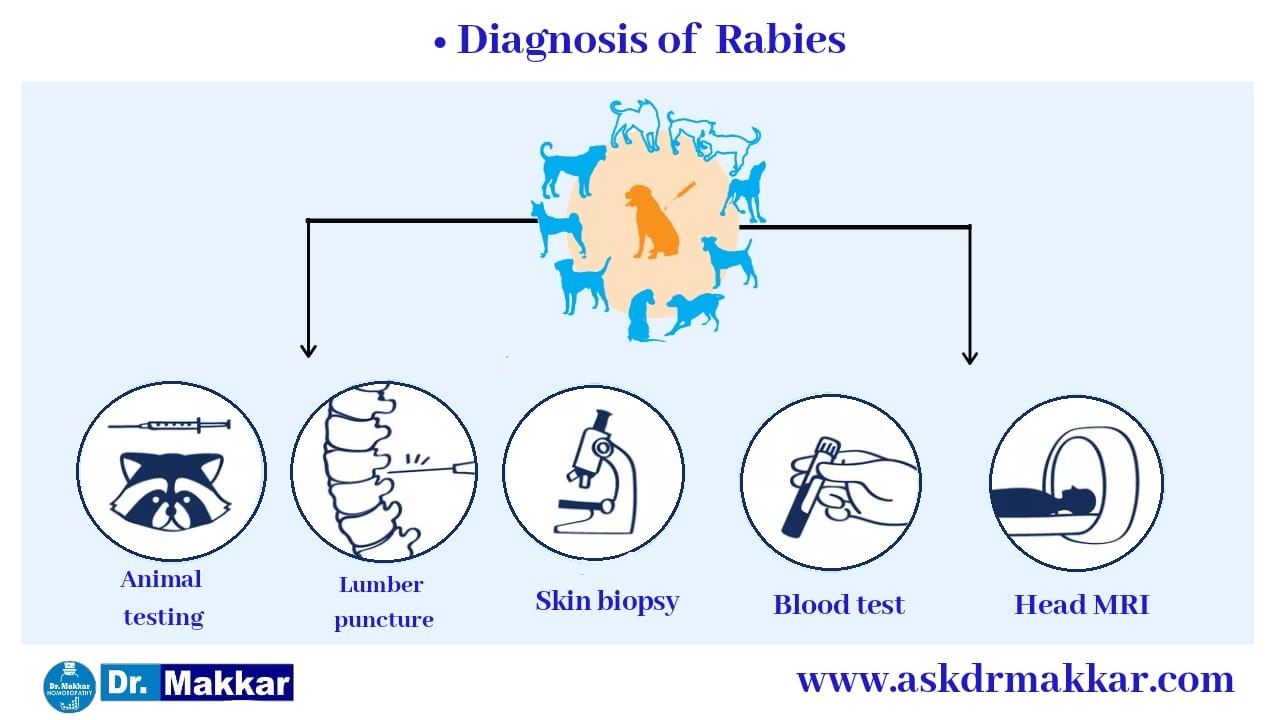 Diagnosis of rabies victim in detail